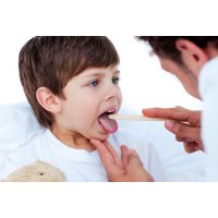 Гнойная ангина у детей: причины, симптомы, лечение