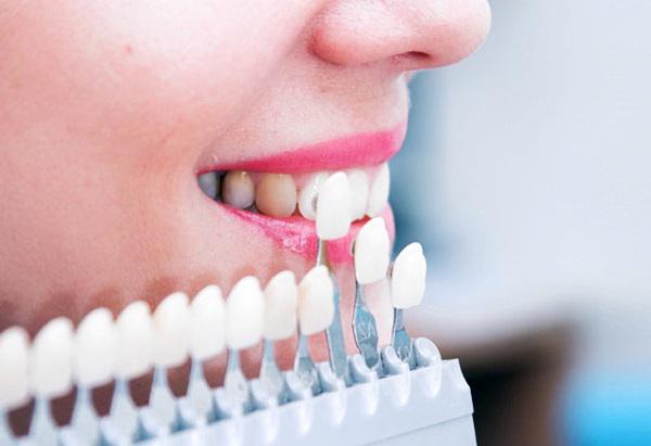 Художественная реставрация зубов: особенности процедуры